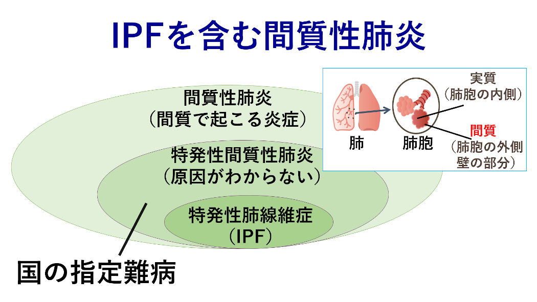 Image01_nibn